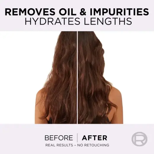 L’oréal Paris Elseve Hyaluron Pure Hair Balm for Oily Scalp and Dry Ends 200 Ml