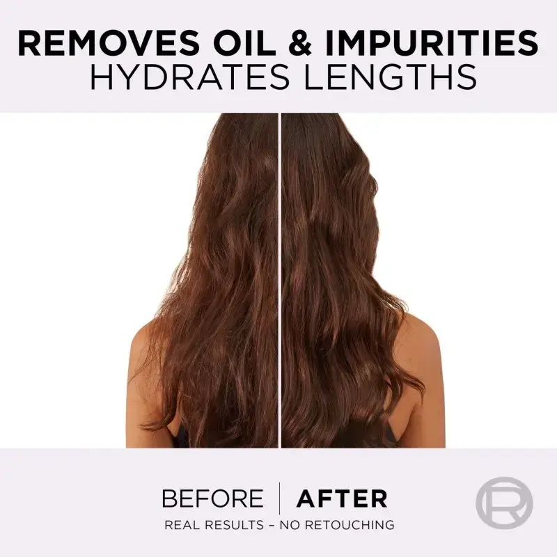 L’oréal Paris Elseve Hyaluron Pure Hair Balm for Oily Scalp and Dry Ends 200 Ml